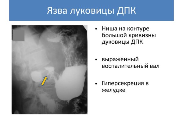 Знают ли власти про маркетплейс кракен